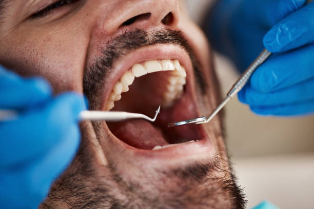 Oral Cancer Screening in Minnetrista, MN